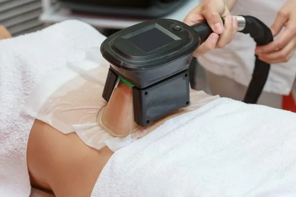 Image of person having fat freezing treatment to help weight gain Alton