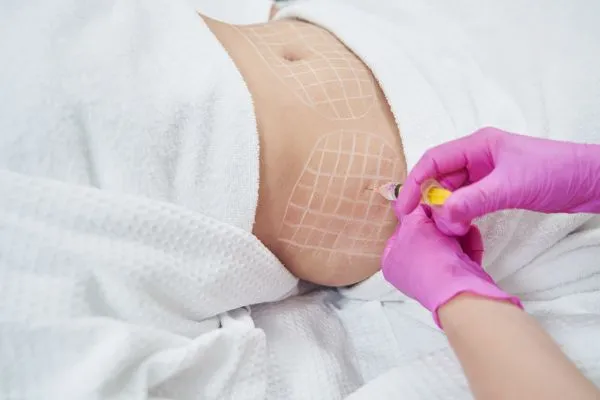 image of fat dissolving injections on love handles to help combat weight gain Alton