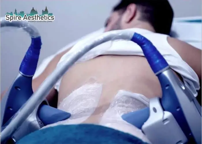 Man having fat freezing treatment done on love handles before a competitions Alton to create a sculpted look.