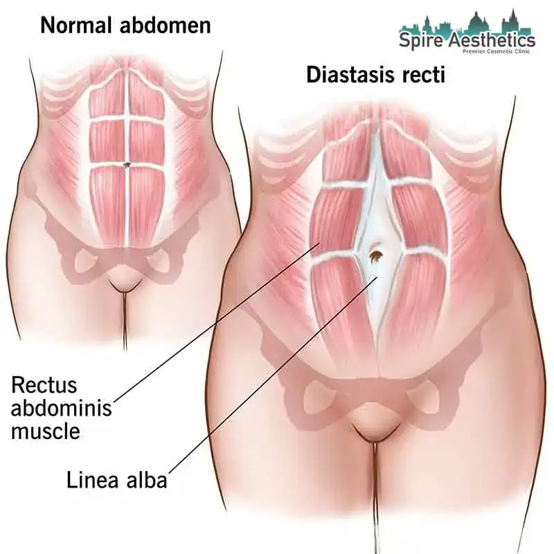 When Will My Belly Feel Normal Again Alton?