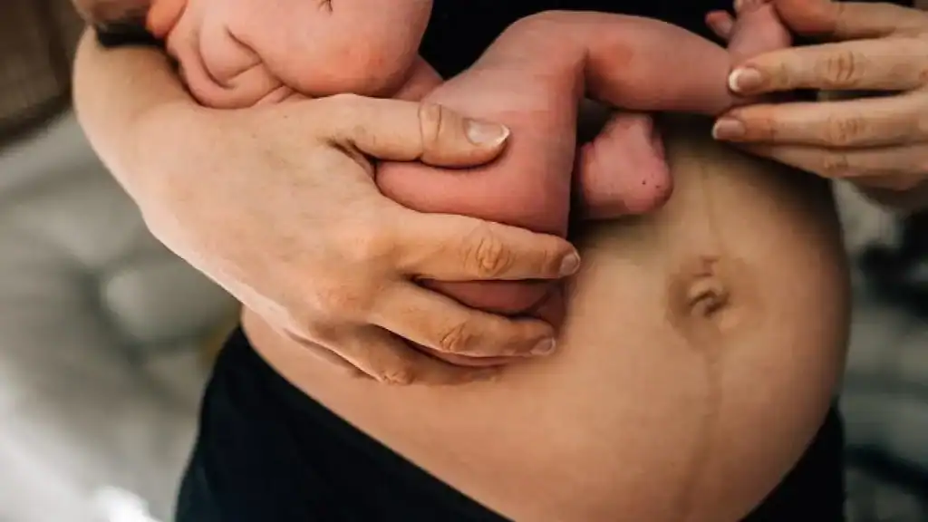 Why Is My Stomach Still Big After Pregnancy Alton?